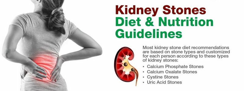 can green tea extract cause kidney stones_2 can green tea extract cause kidney stones_2