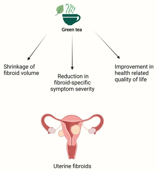 Drink Green Tea Extract When Pregnant_1 Drink Green Tea Extract When Pregnant_1